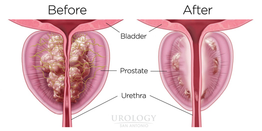Healthy urinary comfort illustration